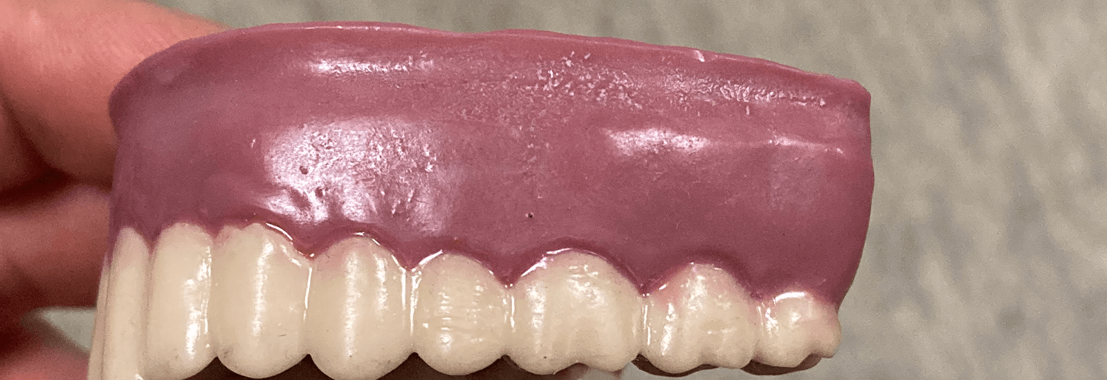 Dental Testdruck 2 Farbig im SLA Verfahren