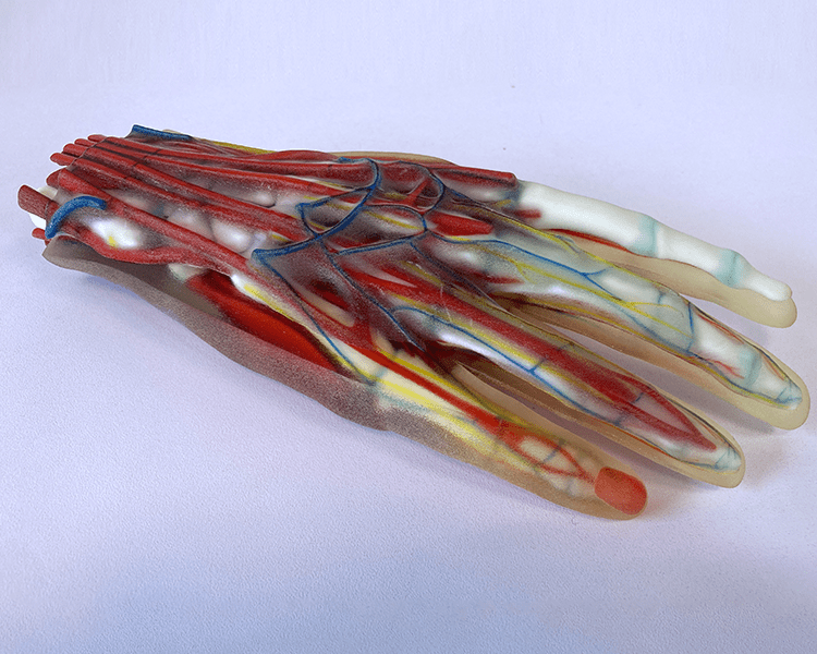 PolyJet Druck Hand mit Gefäßen